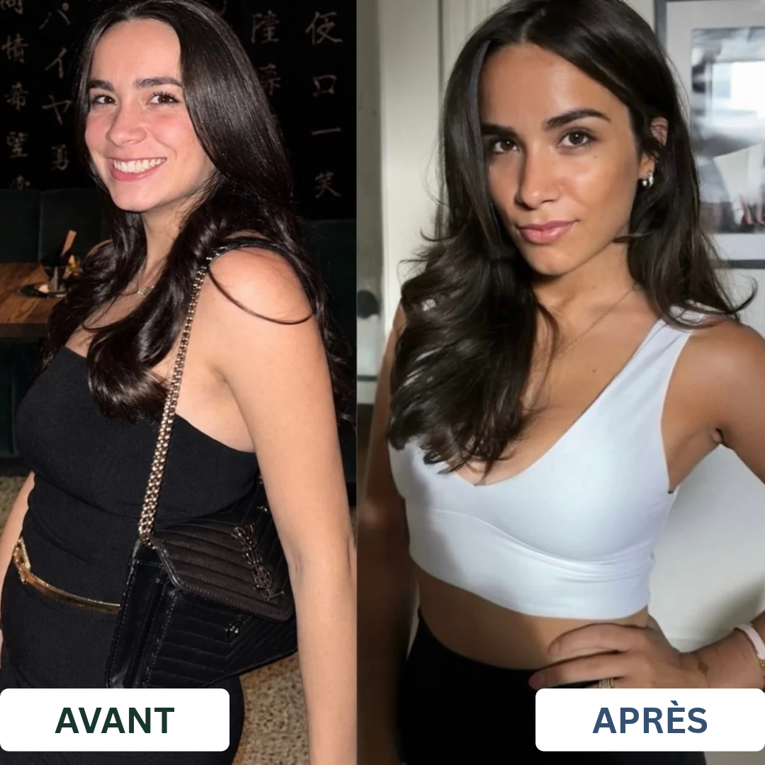 Zoé Thuillier — Avant et Après
