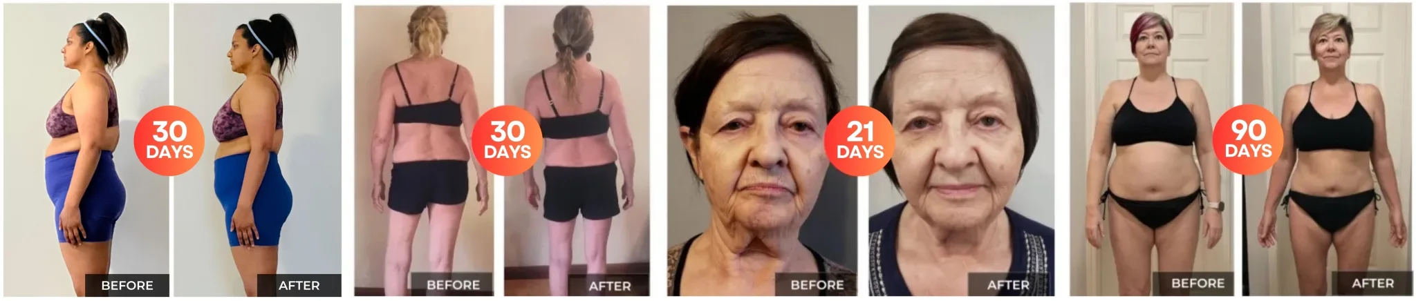 Fascia decompression before and after transformation results 2