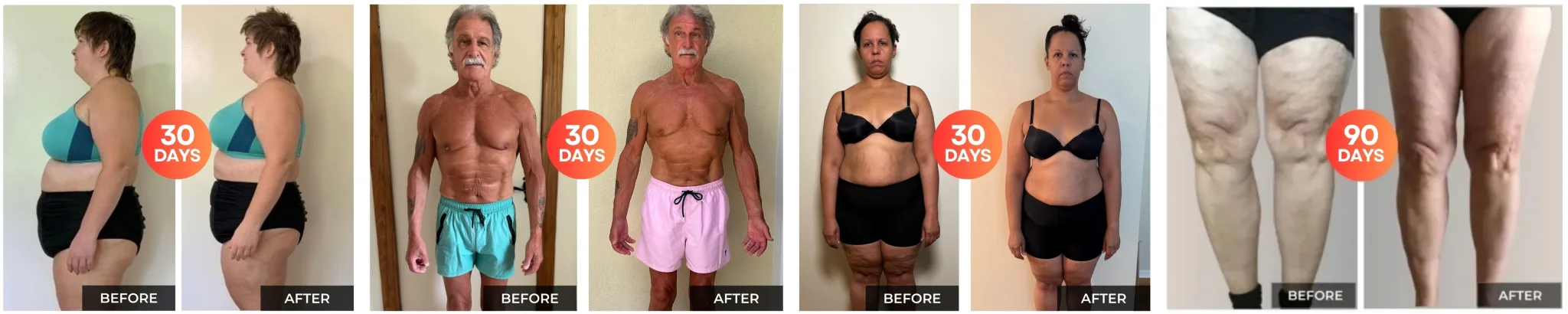 Fascia decompression before and after transformation results 1