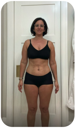 Renee after