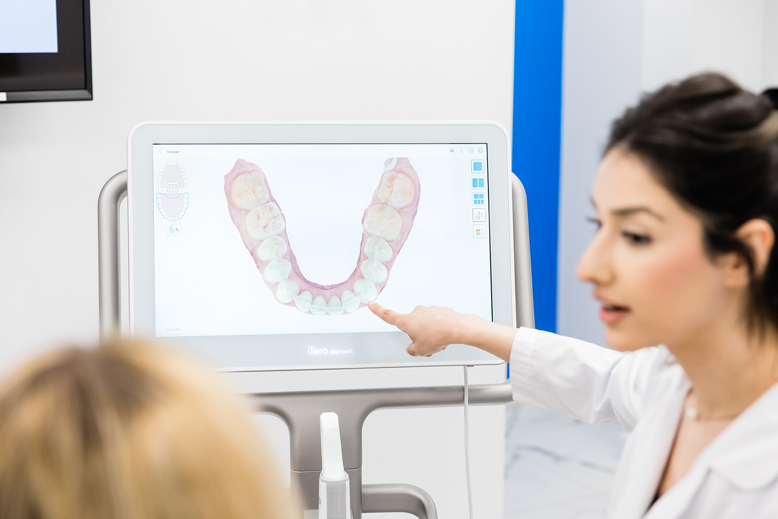 Close-up of iTero scanner in use