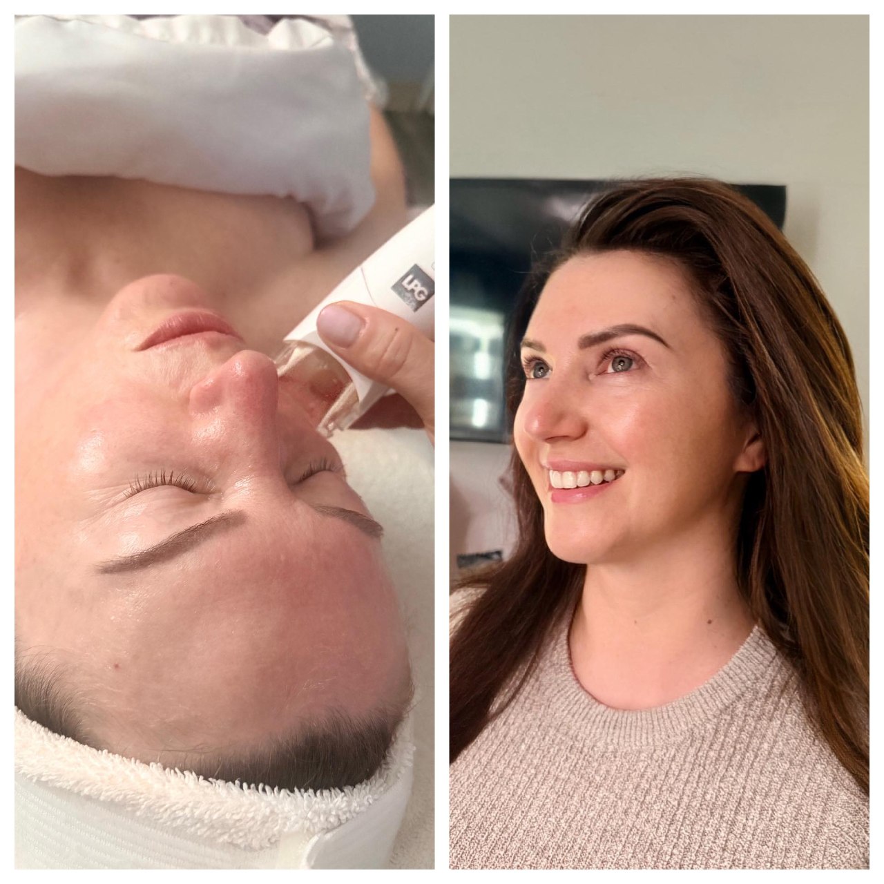 LPG endermologie facial treatment at Wild Orchid Spa