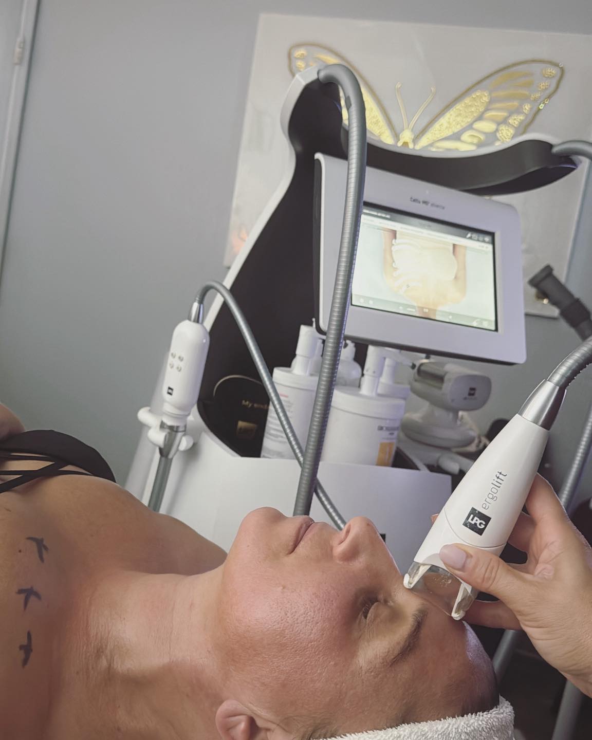 LPG endermologie facial treatment at Wild Orchid Spa