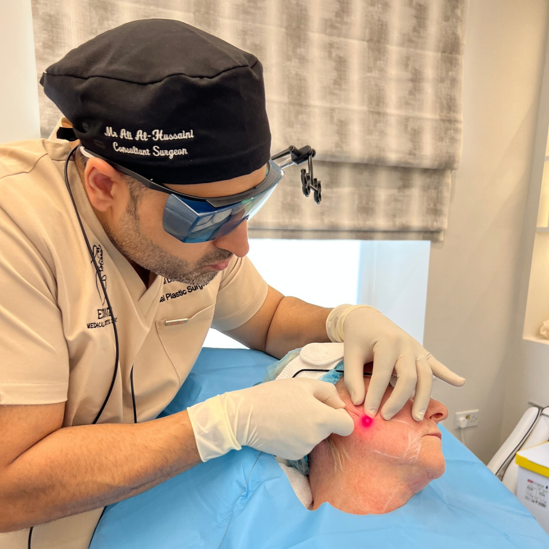 Endolift laser treatment