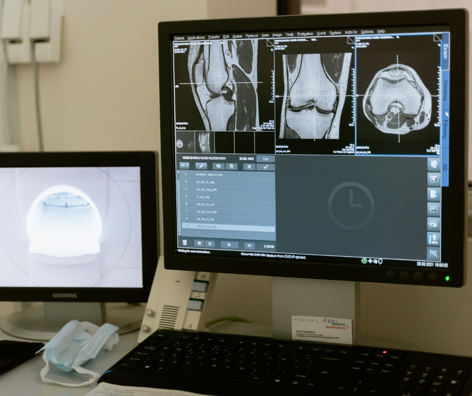 Radiología Digital - Panel DR y equipo de rayos X