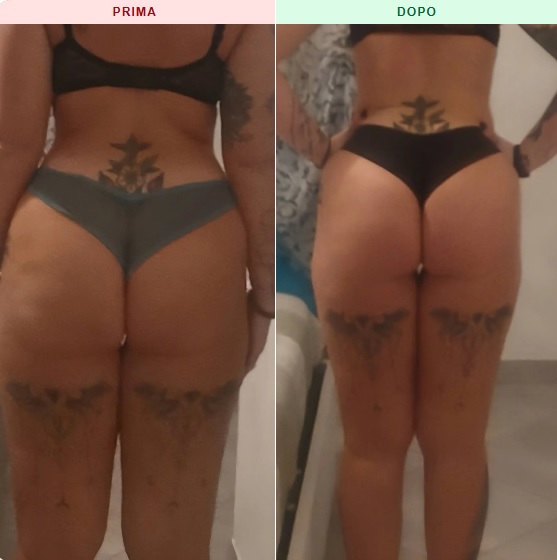 Risultato prima e dopo