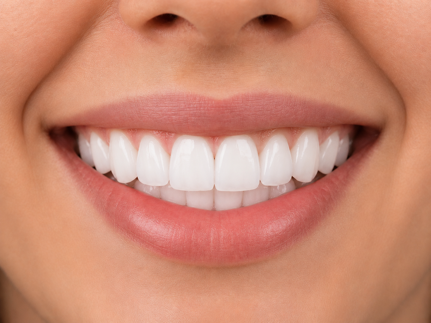 Smile transformation after treatment
