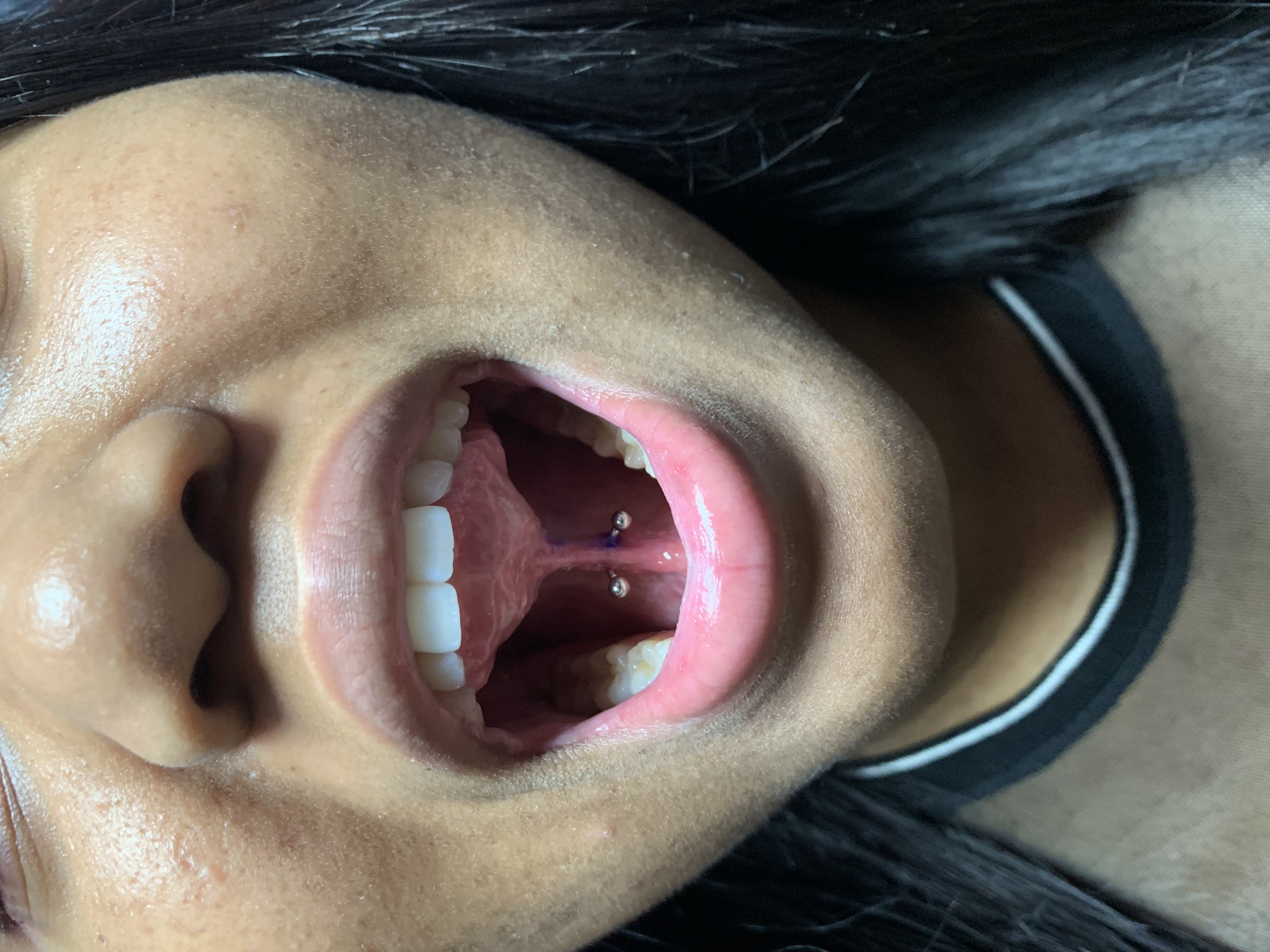Close-up of a person’s open mouth showcasing two oral piercings, highlighting the craftsmanship of body modification by Mariano at GameFace Tattoos.