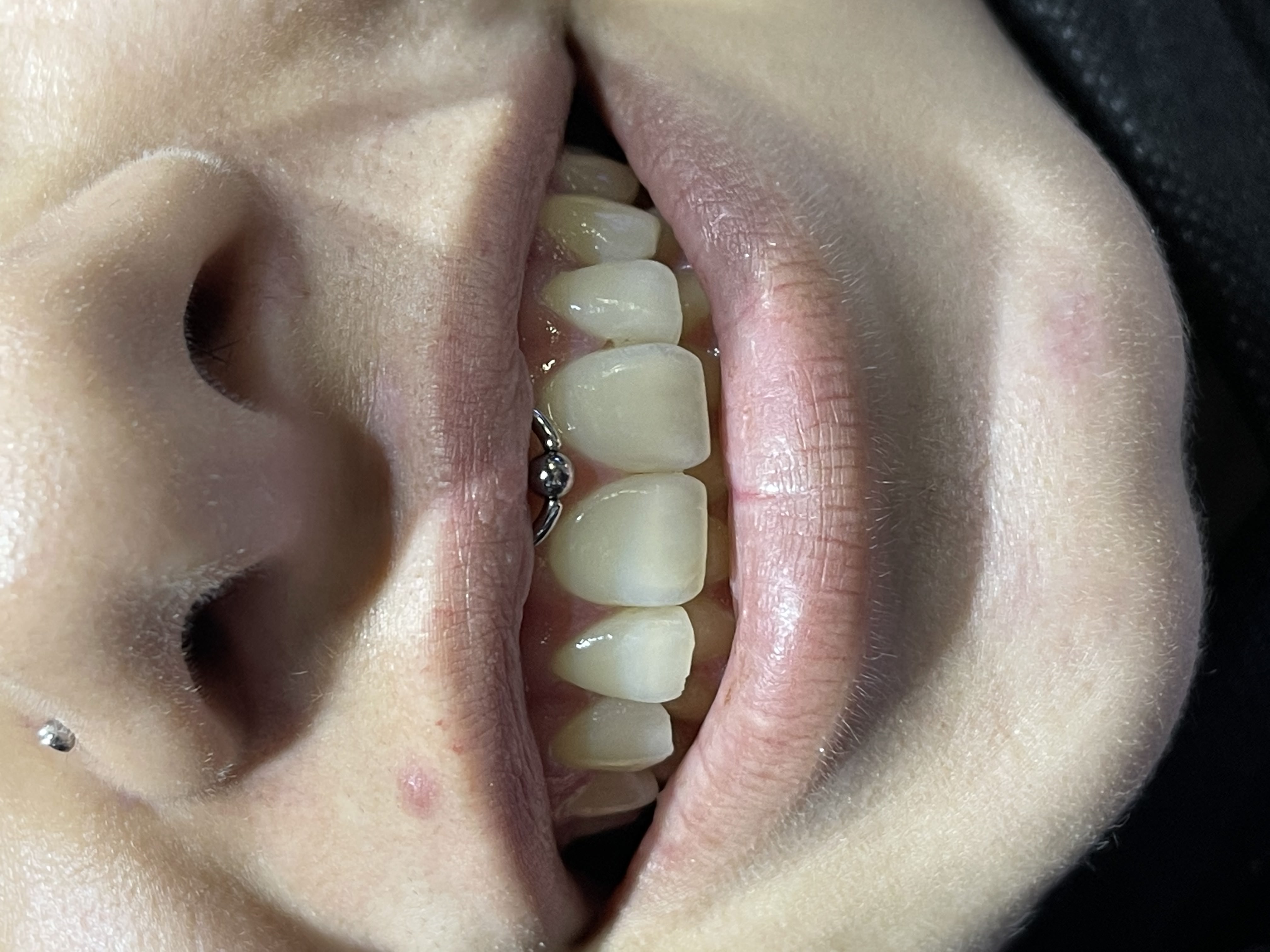Close-up of a smiling person showcasing a lip piercing and a nostril piercing, highlighting the artistry of body modification by professional piercer Mariano at GameFace Tattoos.
