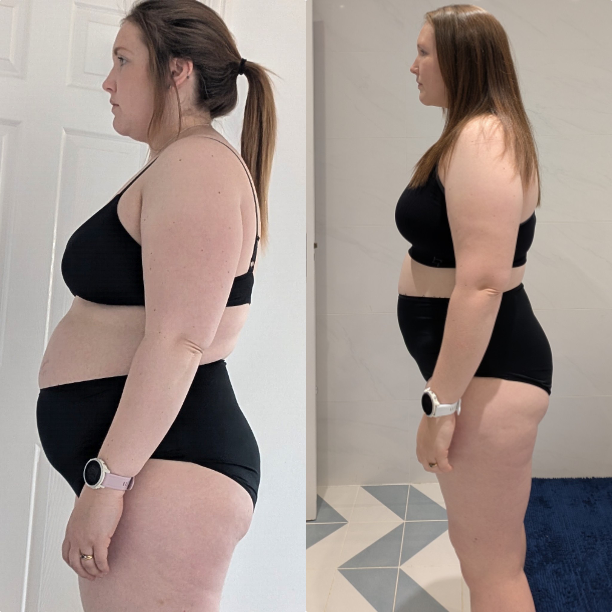 OPE before and after result
