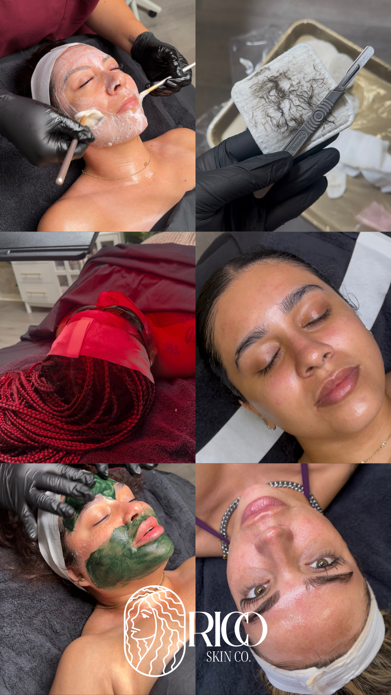 Professional facial treatment focused on corrective skincare and skin health near Lakewood, CA. Professional facial treatment focused on corrective skincare and skin health near Lakewood, CA.