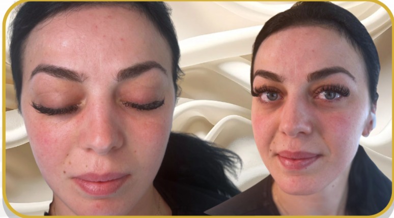 <h3>Brows &amp; Lashes Reset</h3>