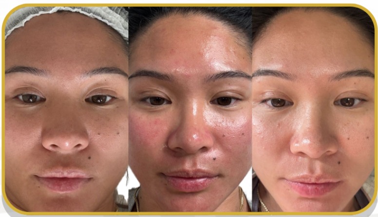 <h3>Weekend Ready Glow</h3>