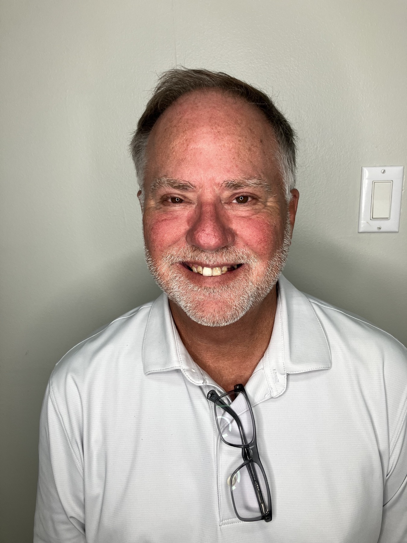 Patient before All-on-4 treatment