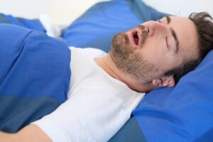 A man with sleep apnea lying on his back and snoring A man with sleep apnea lying on his back and snoring
