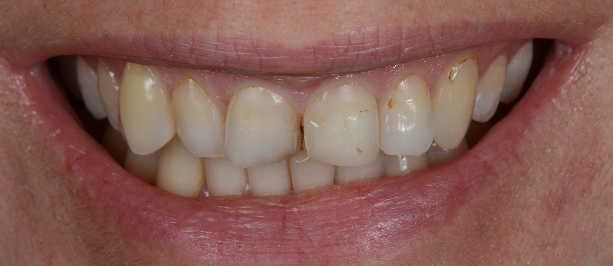 Before transformation