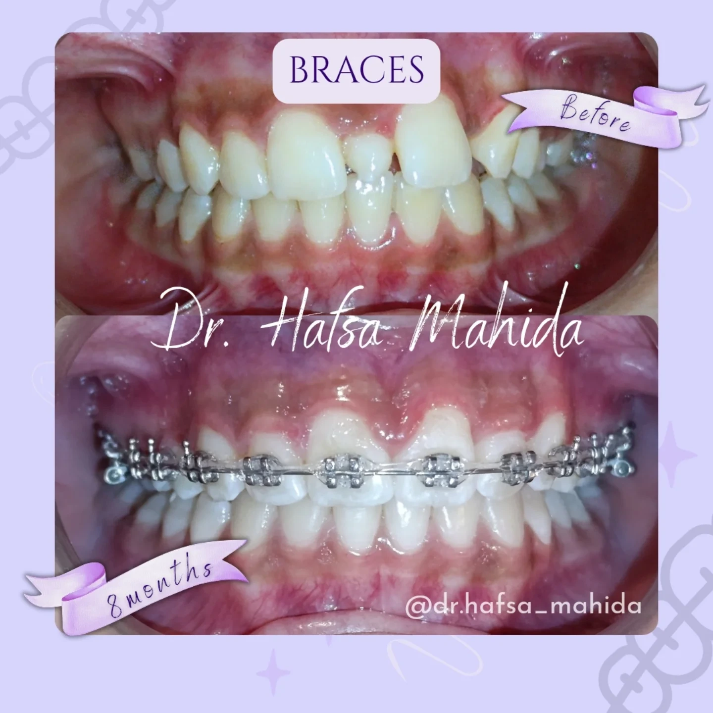 Dental clinic before and after treatment result