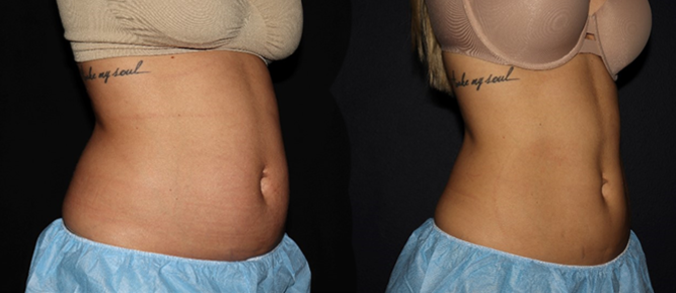 Client result example