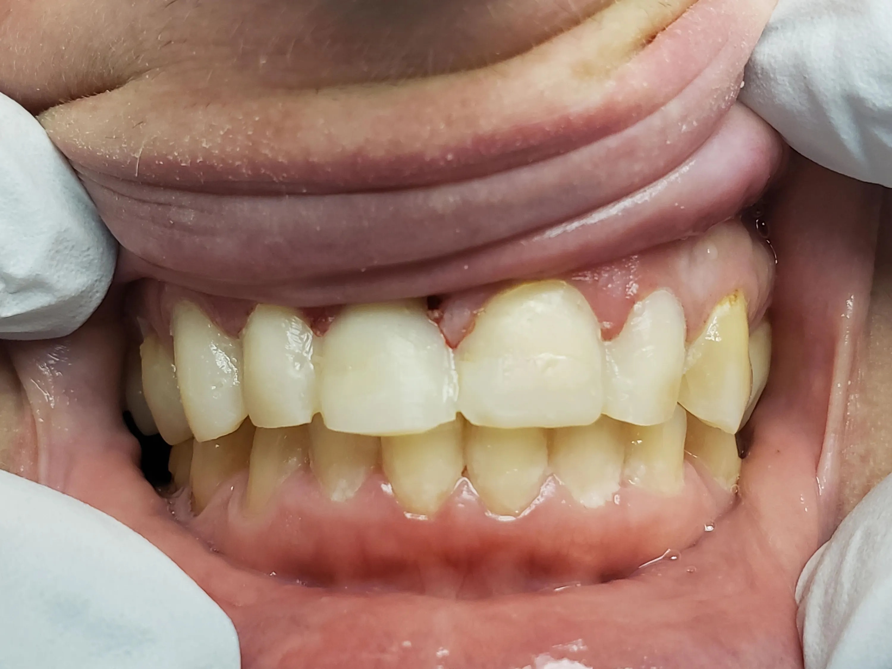 Emergency dentistry at A to Z Magic Dental Richton Park and Flossmoor