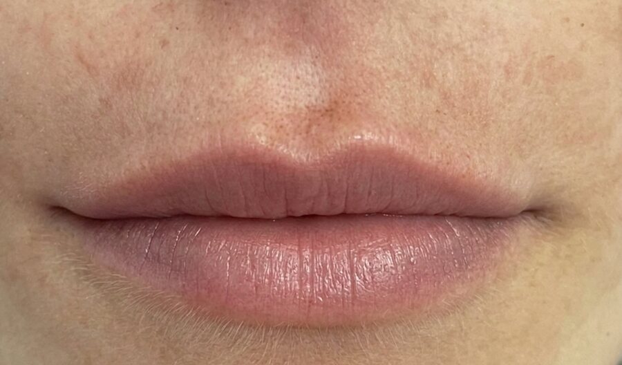 After treatment, Amelia Clinic