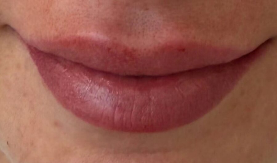 After treatment, Amelia Clinic