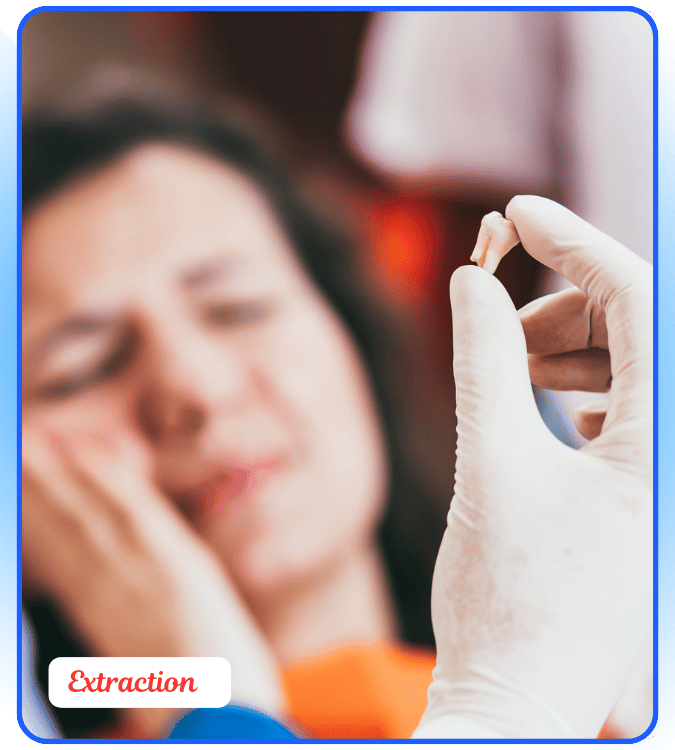 tooth etraction