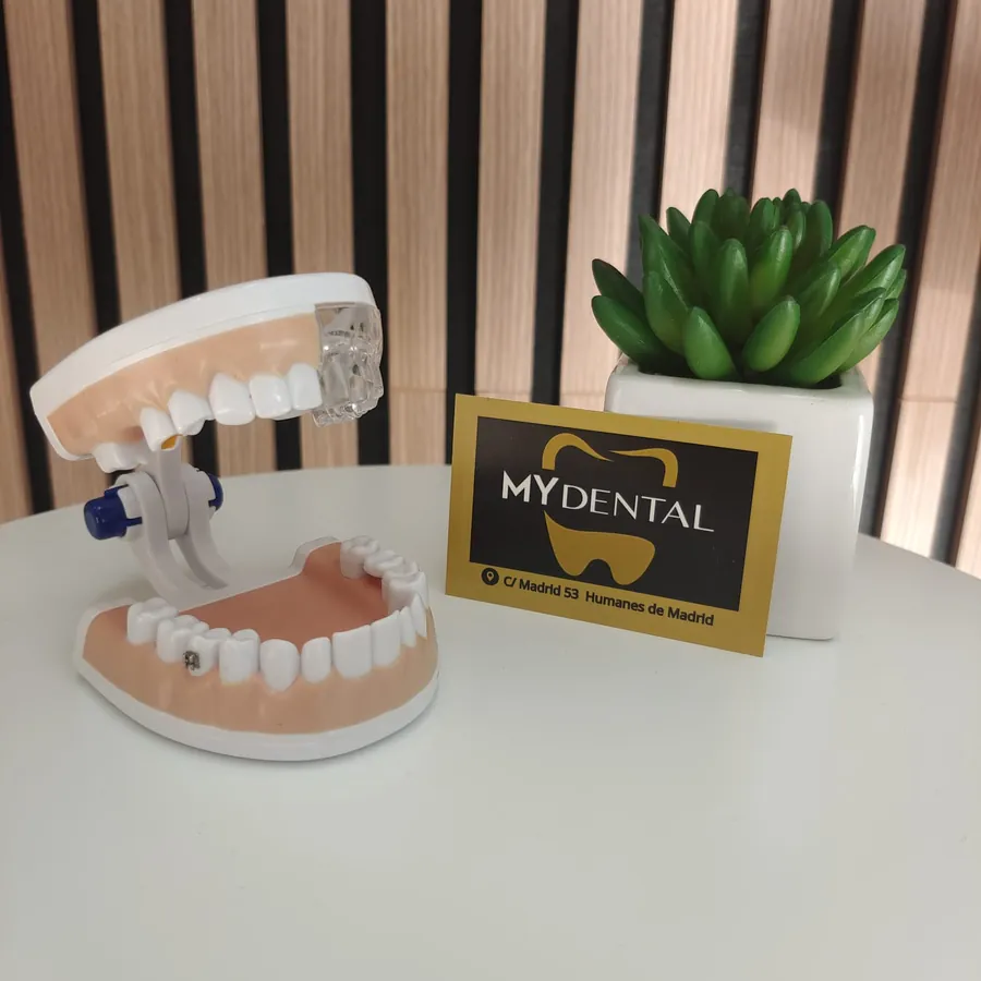 Modelo dental y tarjeta de My Dental en la clínica