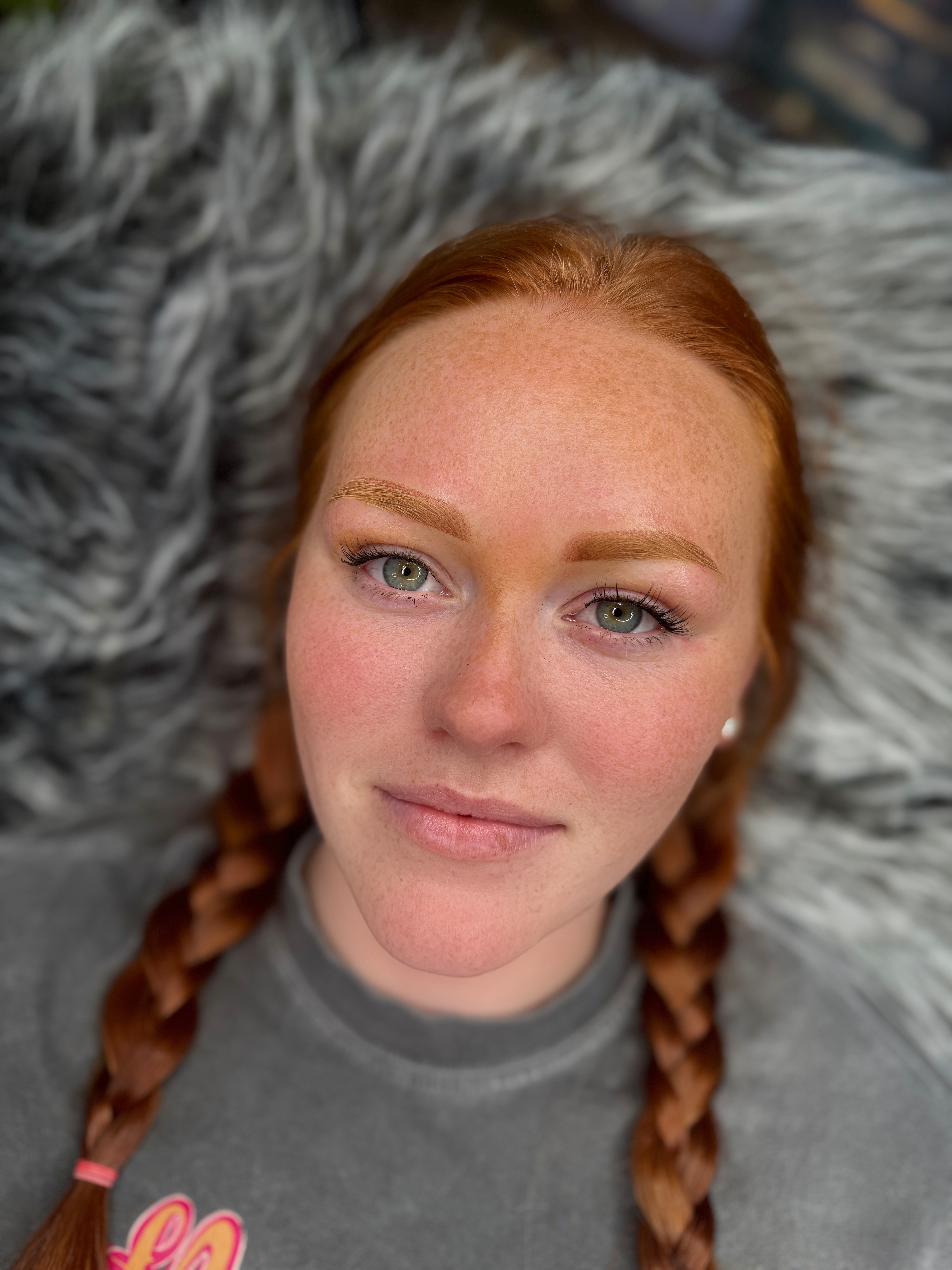 Brows healed result