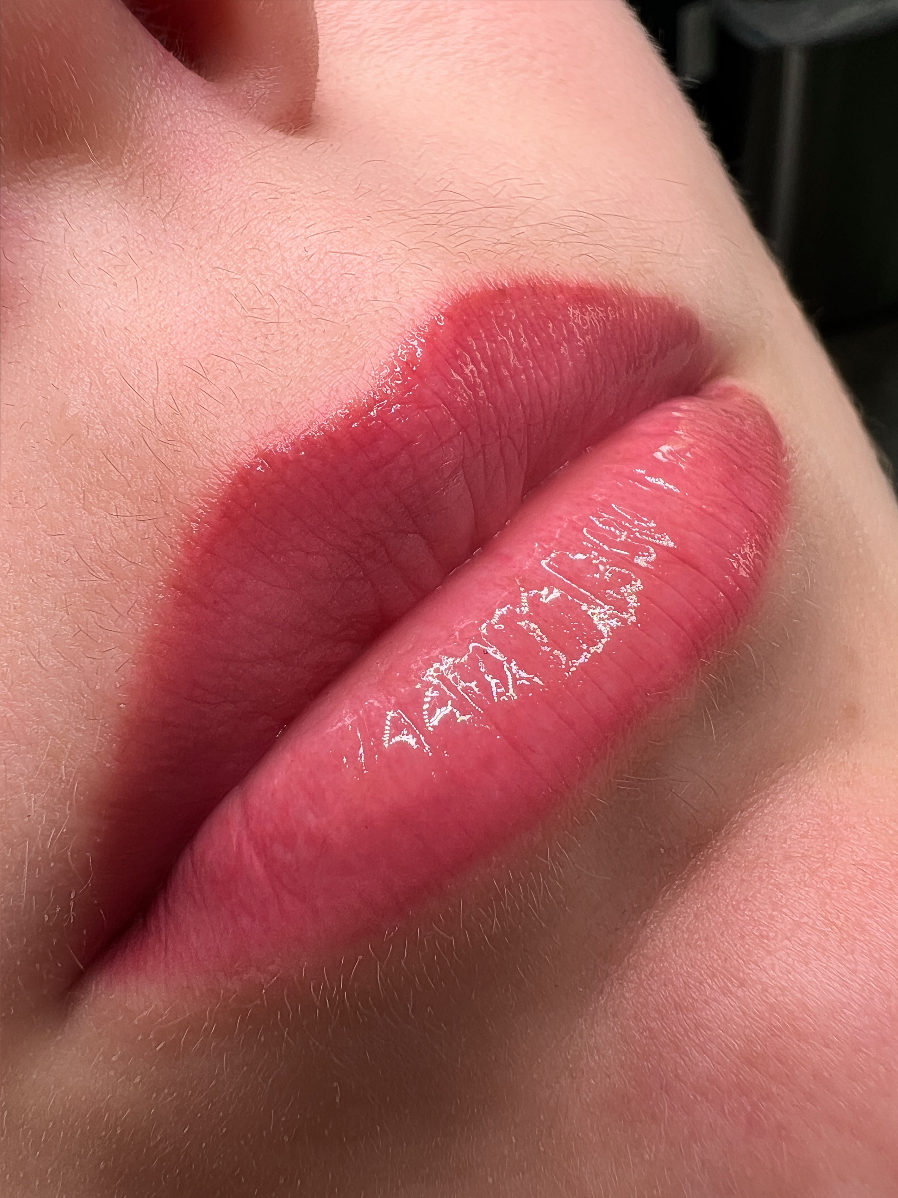 Lips healed result