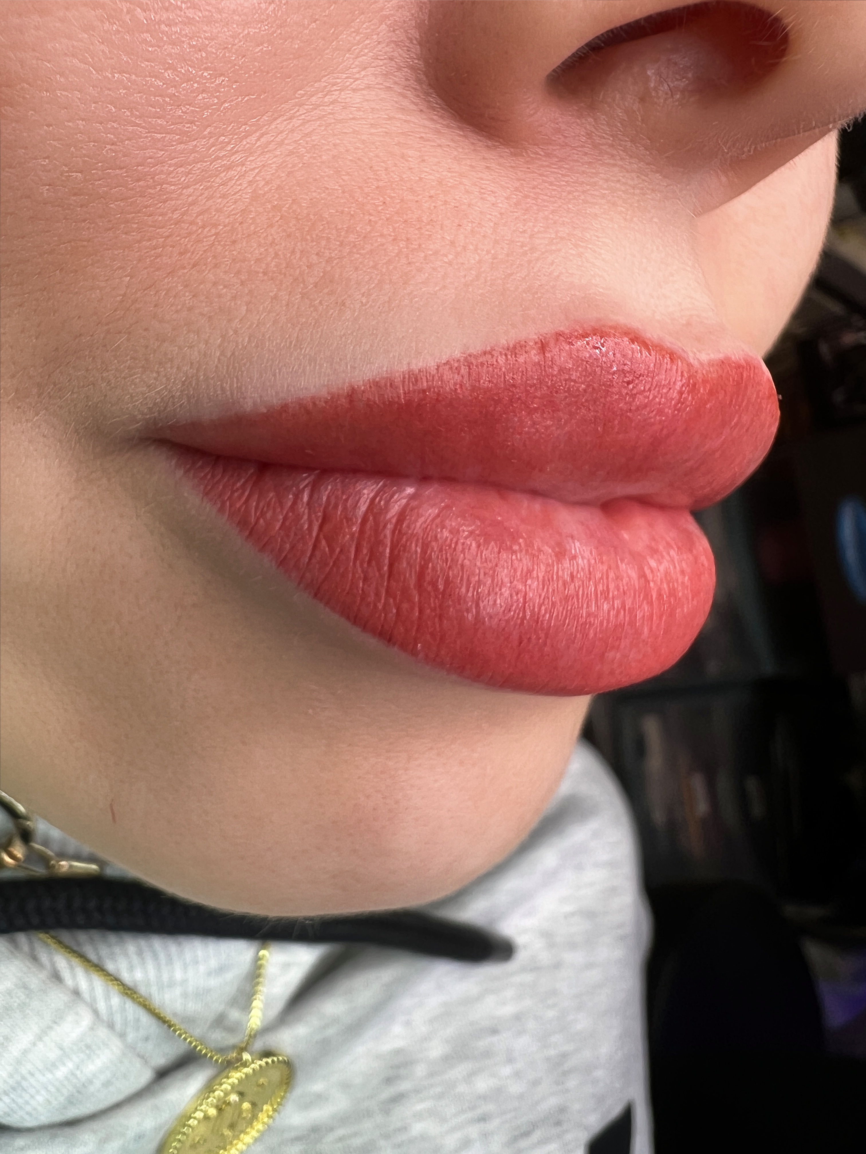 Lips healed result