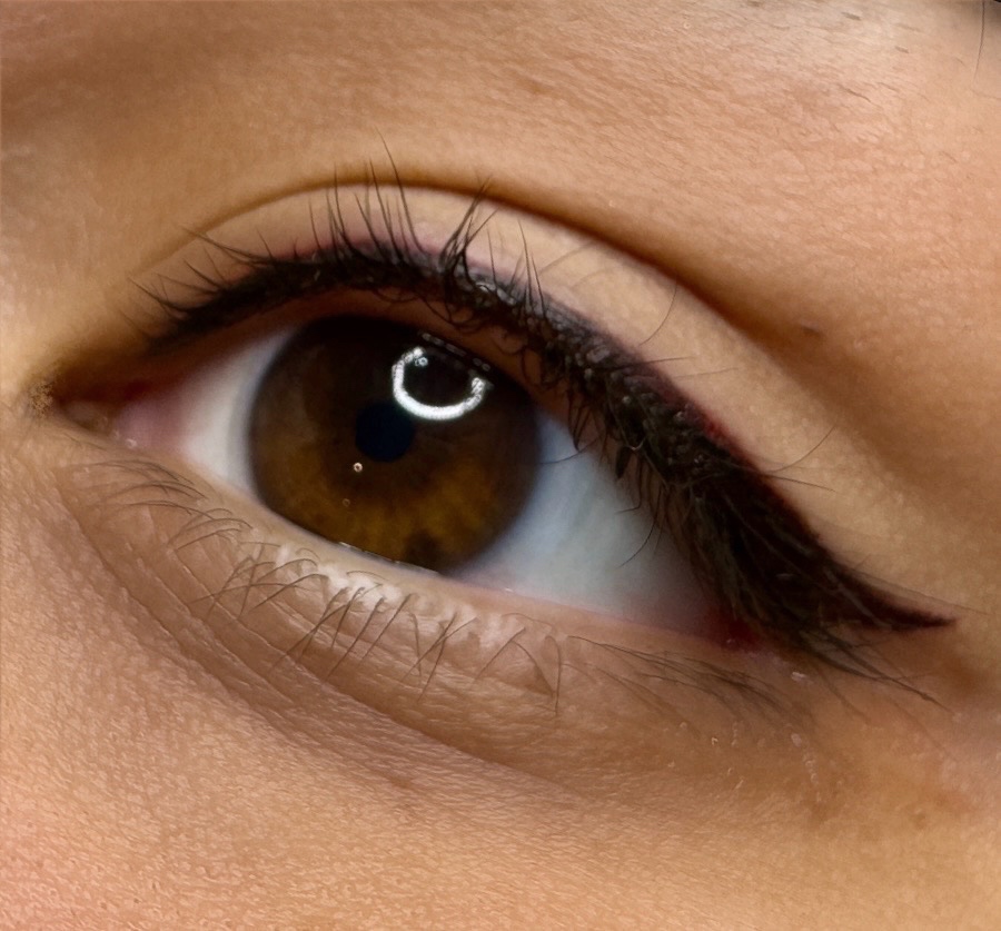 Liner healed result