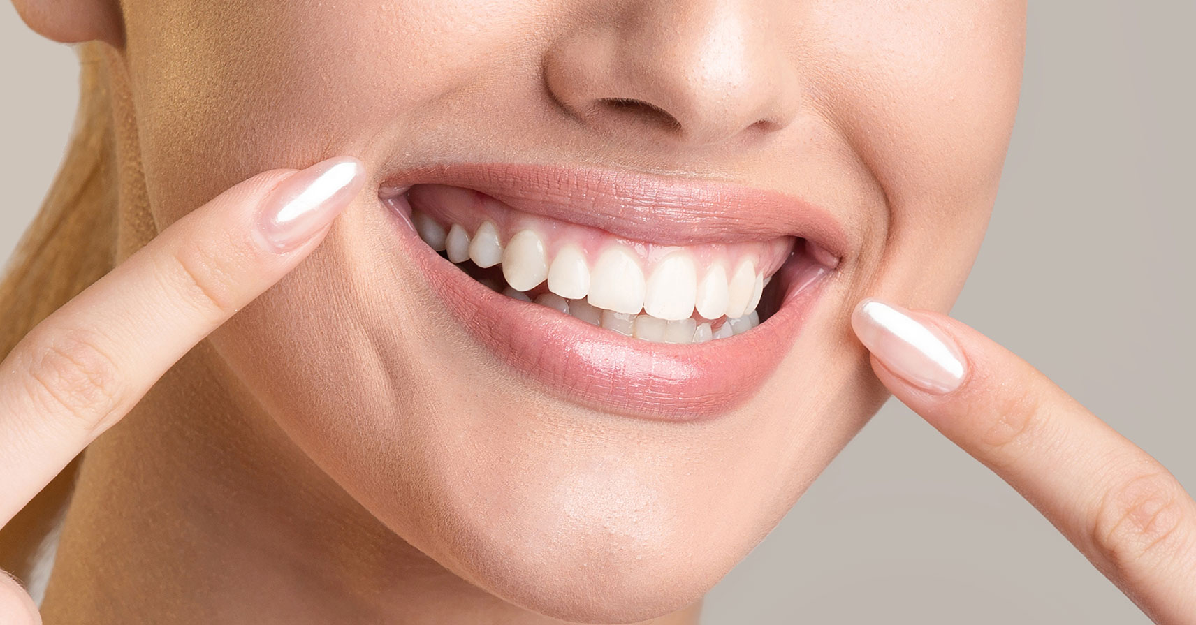 Woman with teeth whitening