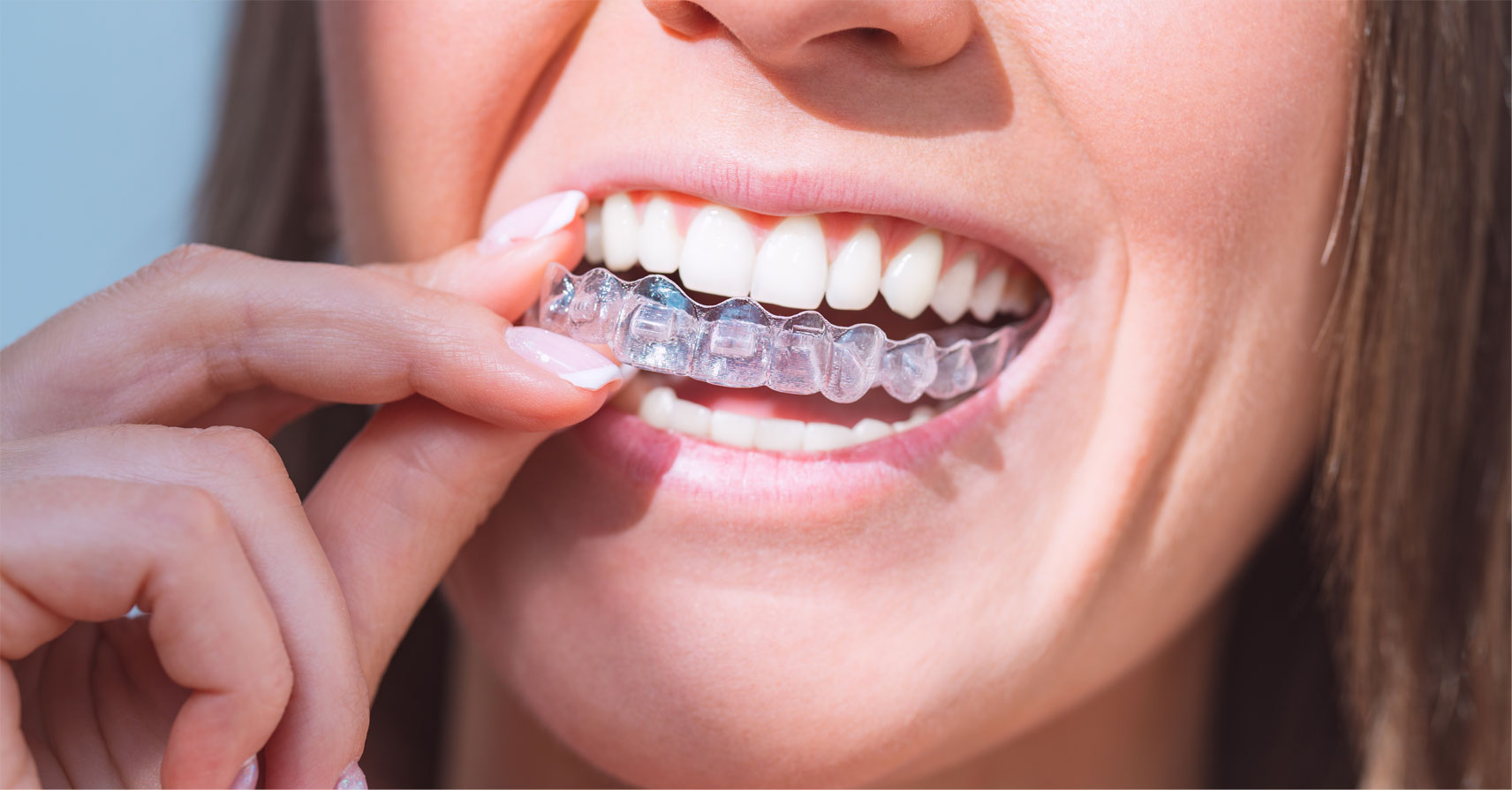 Woman holding invisalign