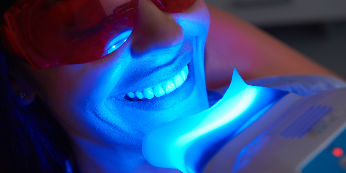 Teeth whitening treatment