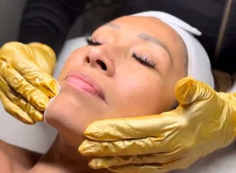 A gloved esthetician cleansing a client's face before a peel