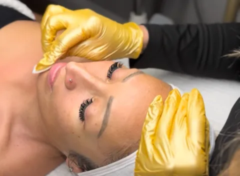 A gloved esthetician working on a client's face during a corrective treatment