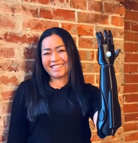 Nora with New Arm Nora with New Arm