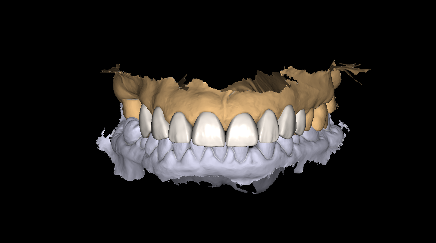 2. 3D Scan and Design