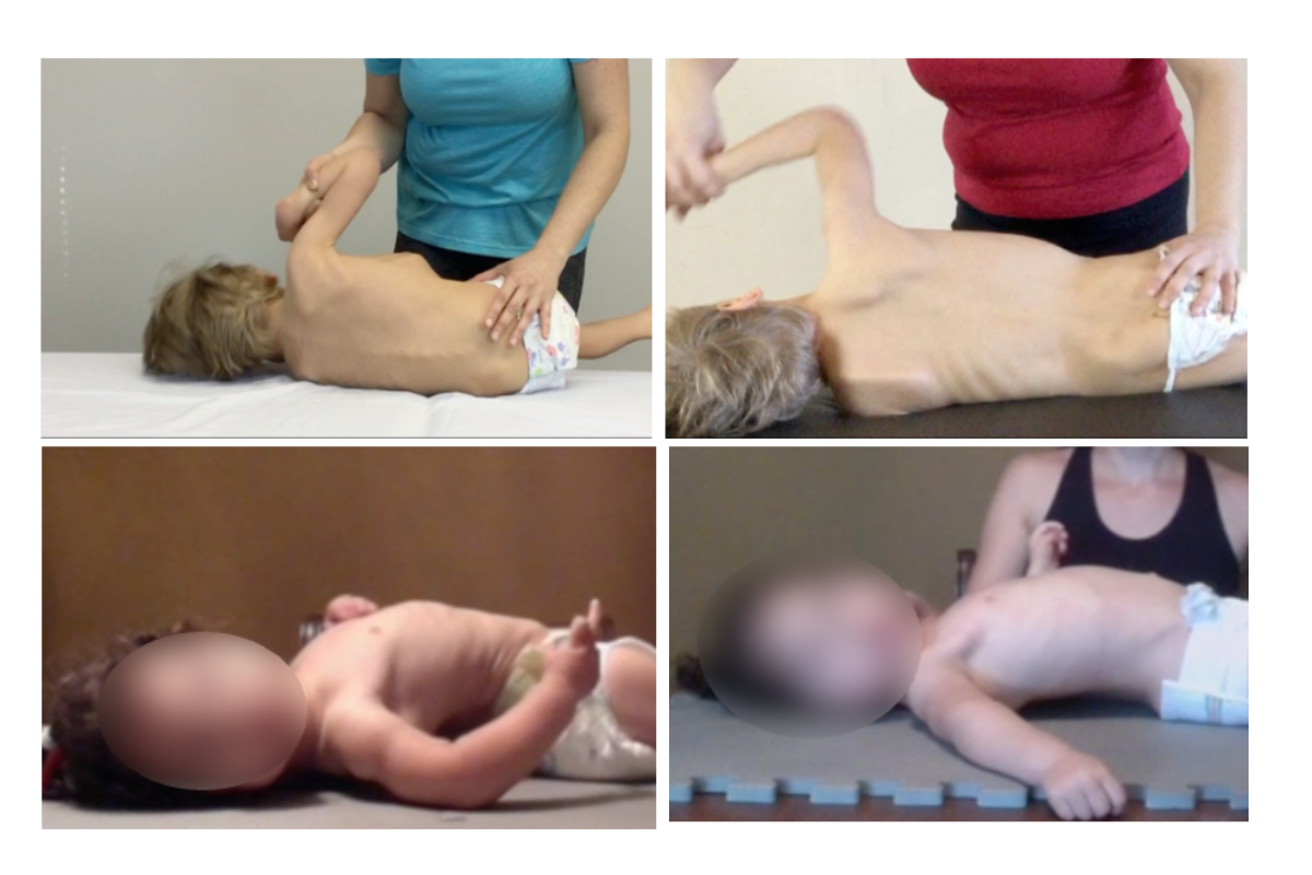 do fascia therapy results last