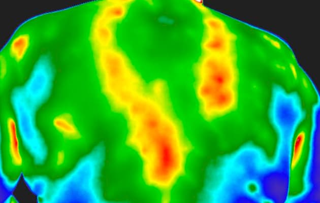 Thermography Image of back from Body in Focus Thermography