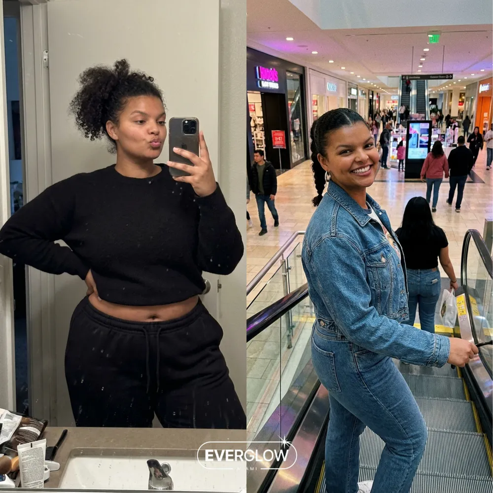 Everglow patient before and after weight loss transformation