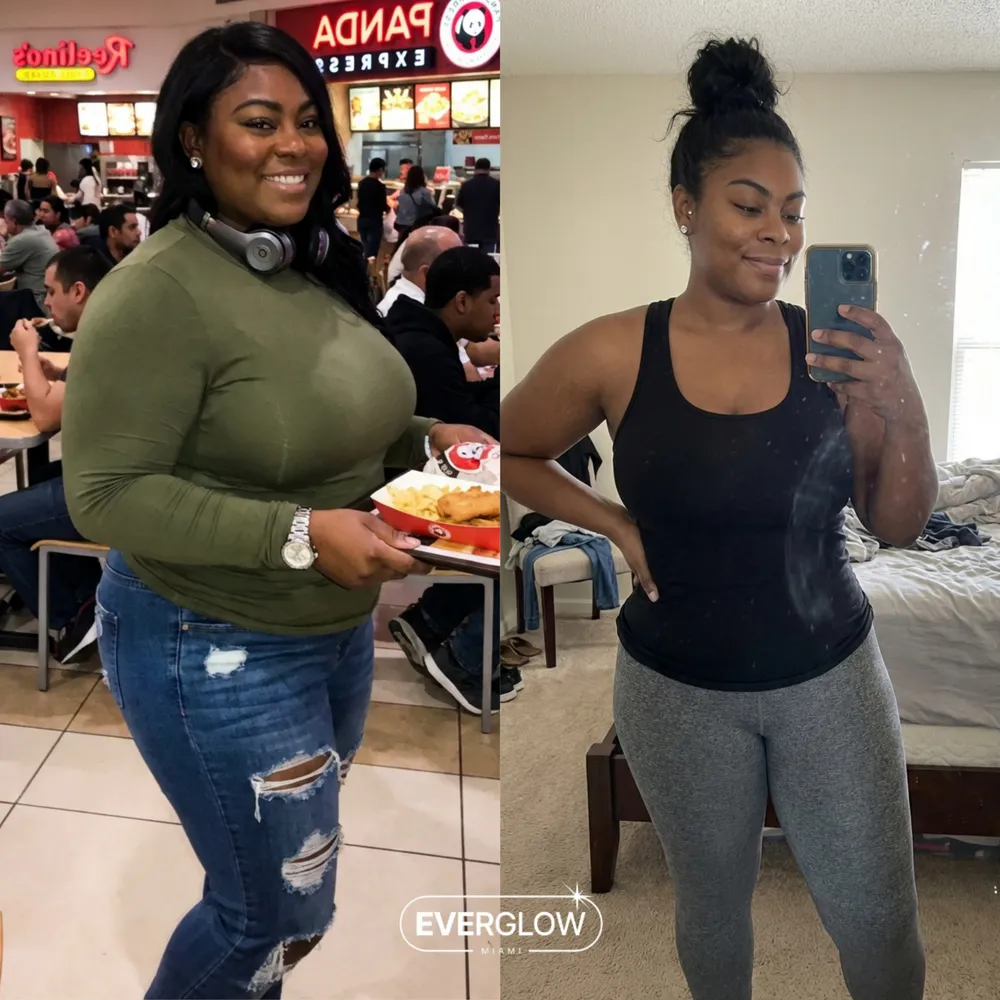 Everglow patient before and after weight loss transformation
