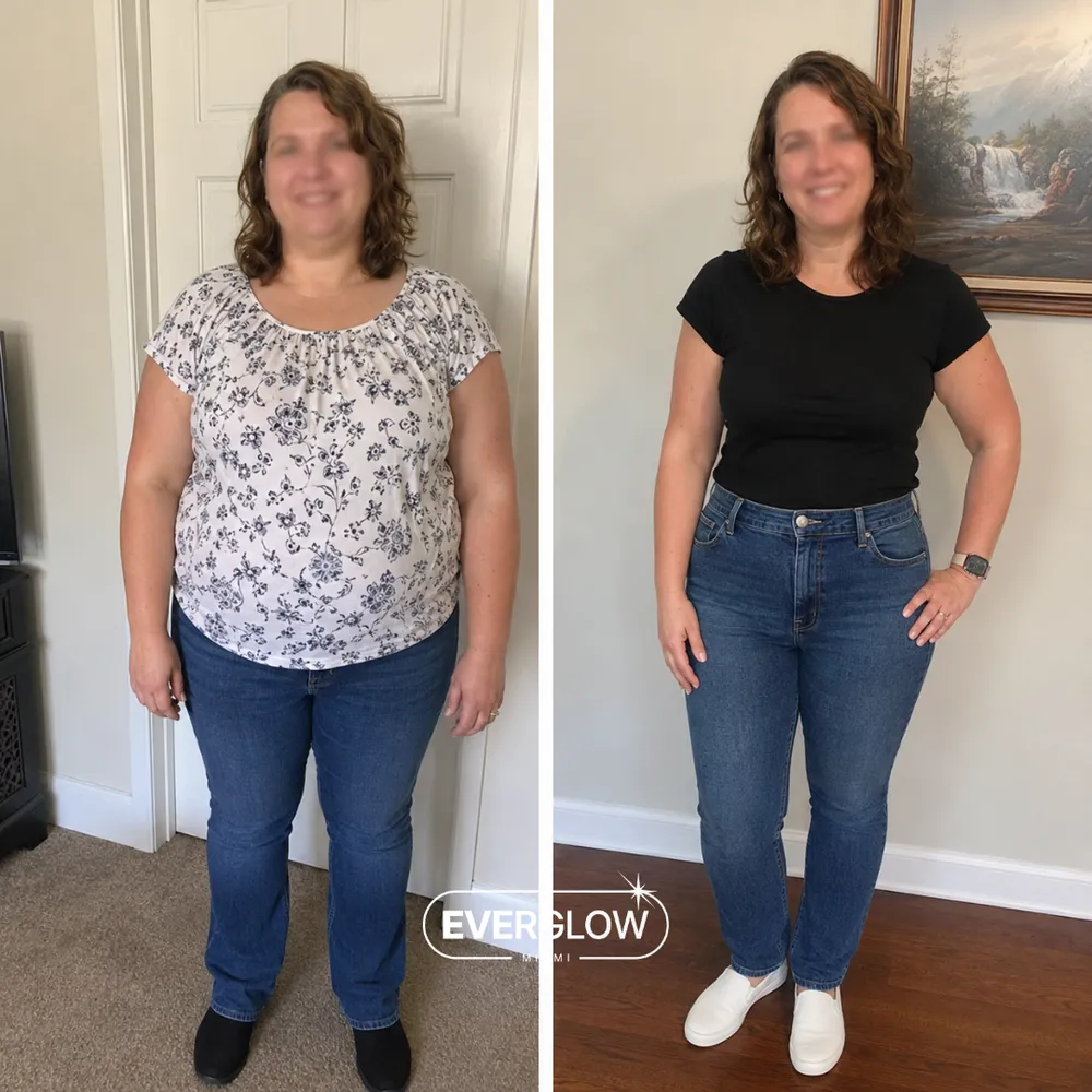 Everglow patient before and after weight loss transformation