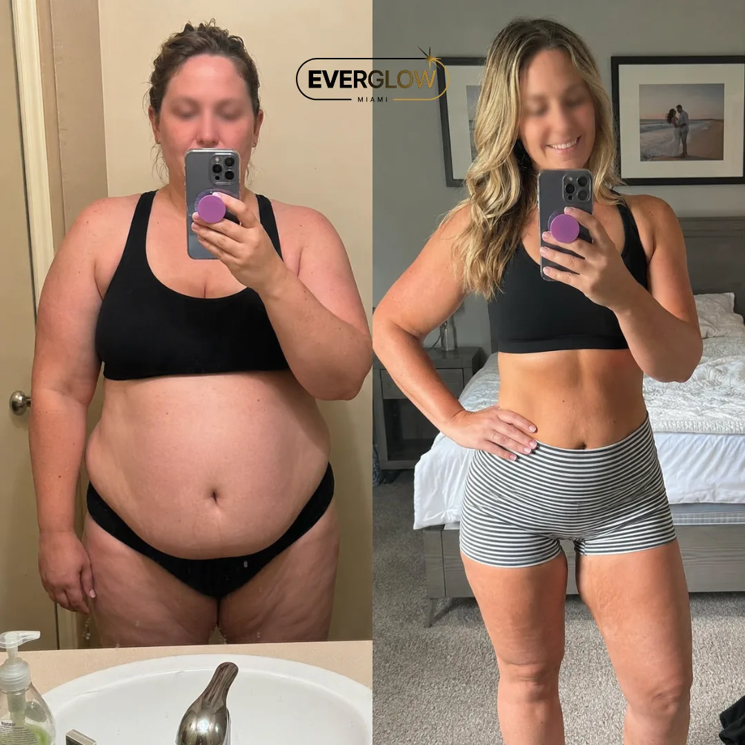 Everglow Miami weight loss patient