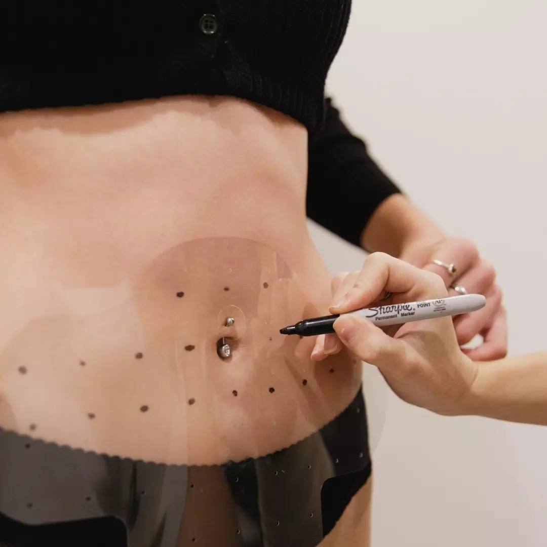 LIPOcel™ body sculpting treatment at Contour Atelier
