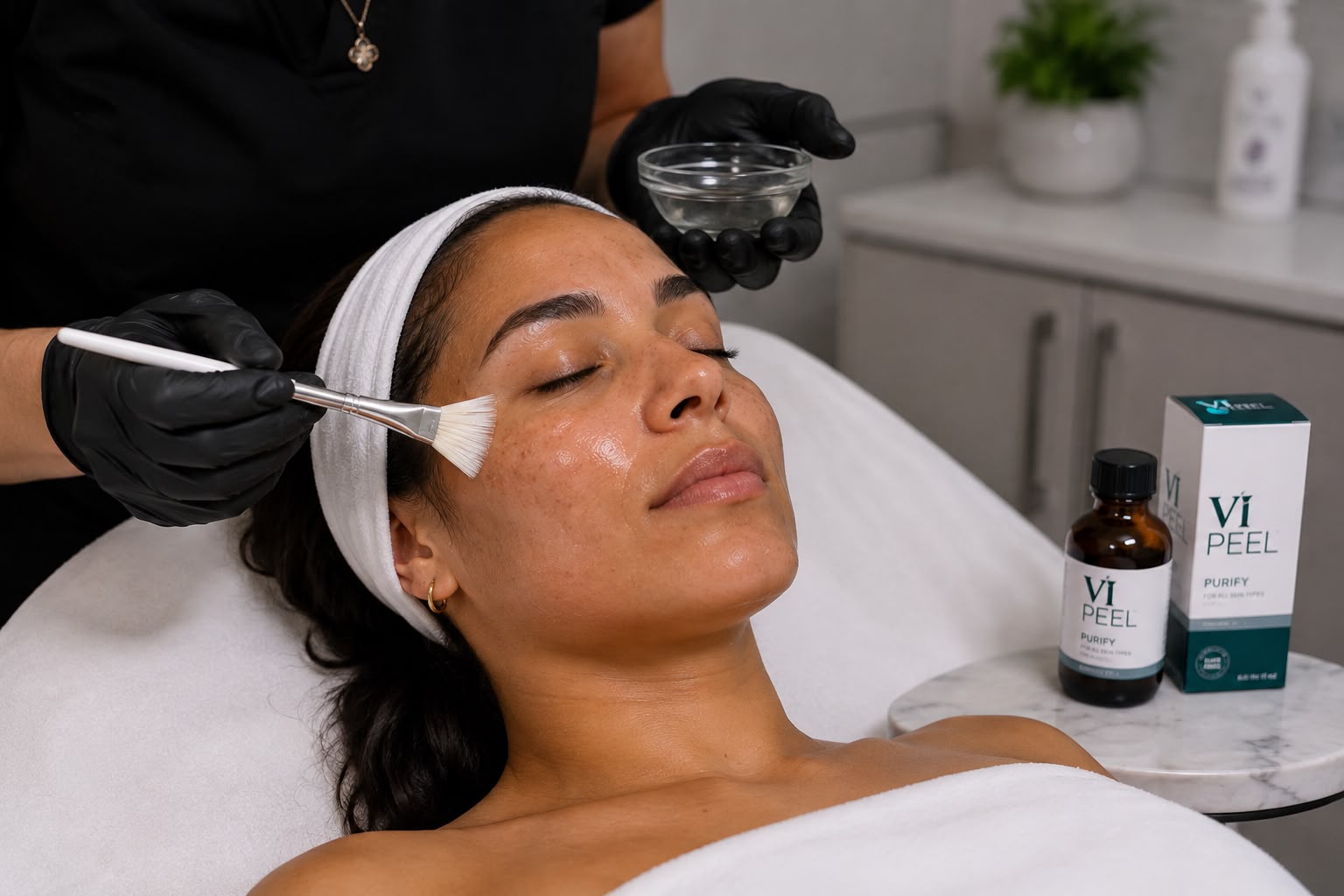 Chemical Peel