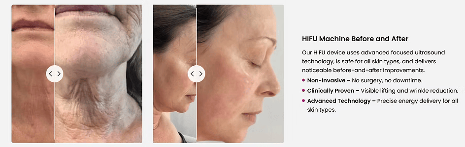 Clinical Before and After