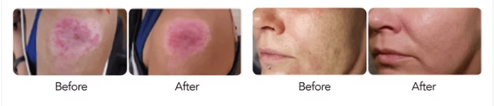 Precision Aesthetic Contouring