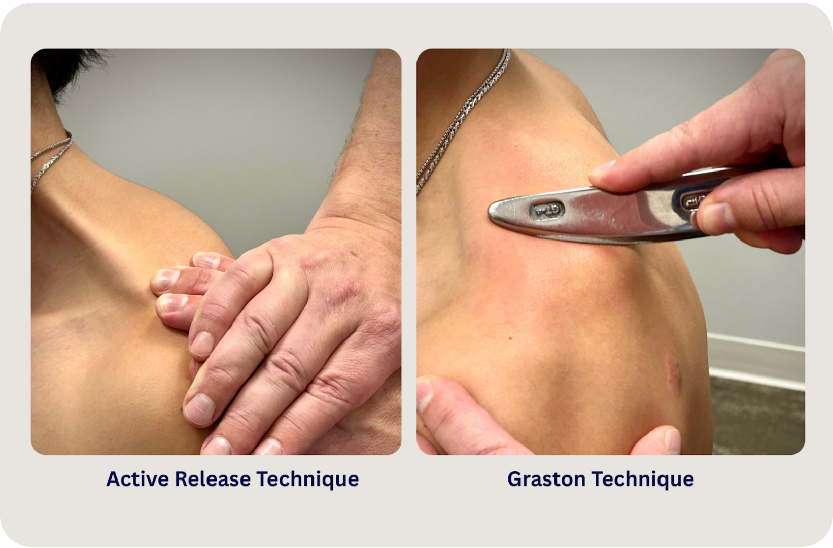 Active Release Technique and Graston echnique