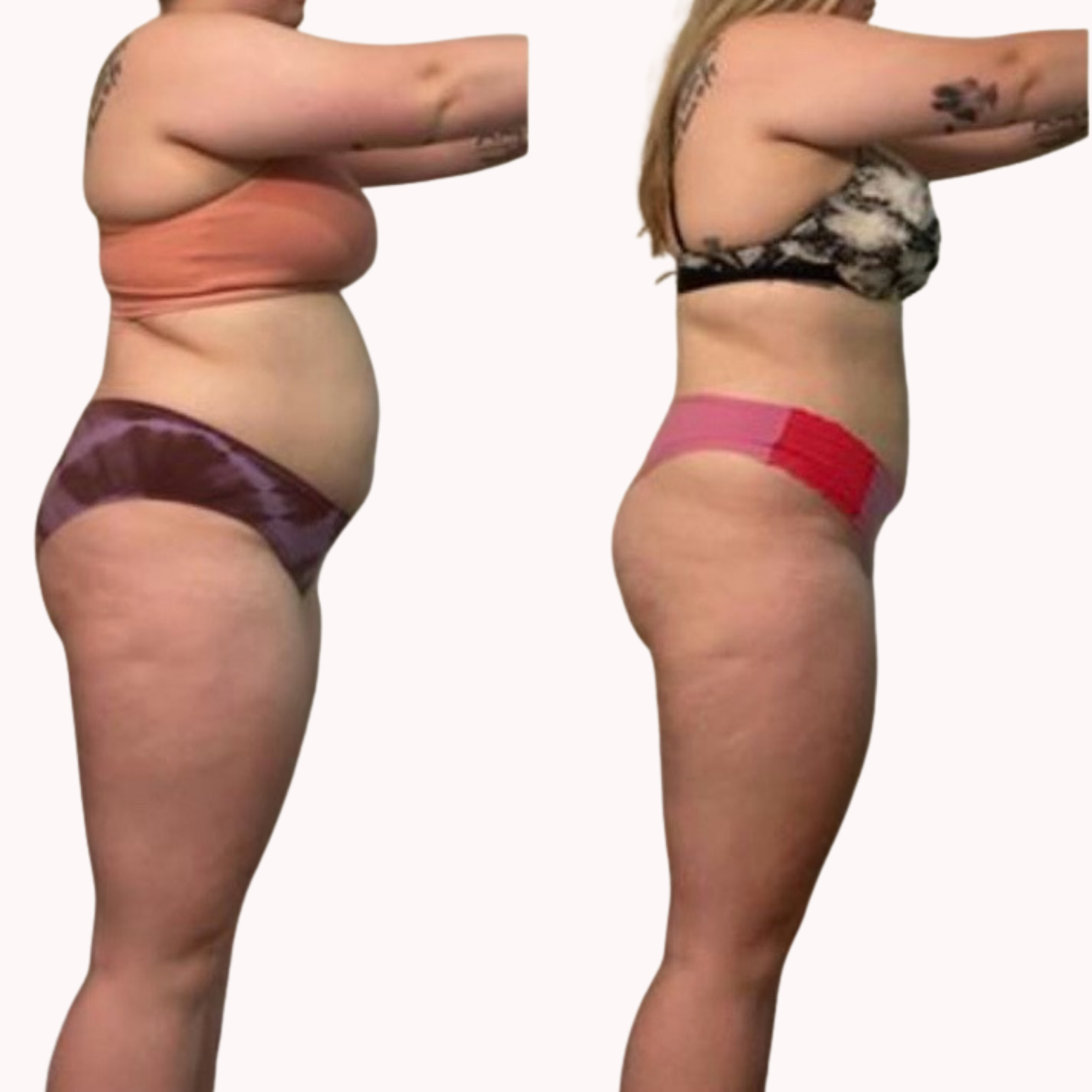 Client transformation